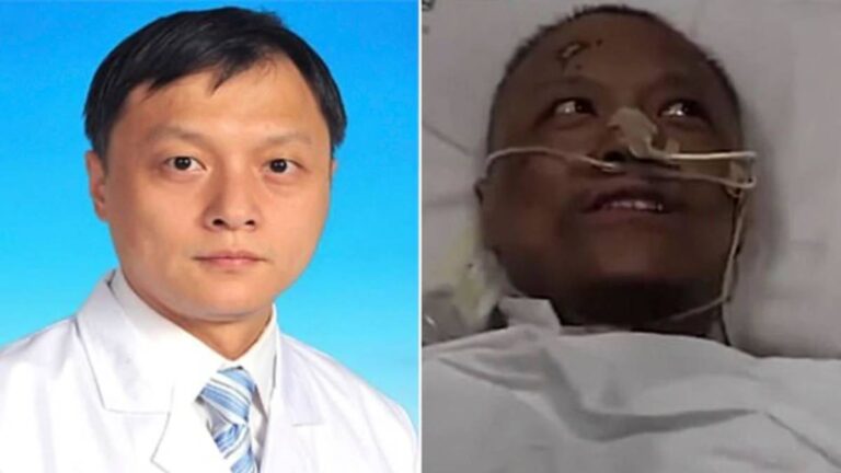 Muere Hu Weifeng, médico chino cuya piel se volvió negra por el coronavirus